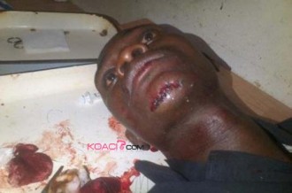 Togo : Un journaliste victime dÂ’une tentative dÂ’assassinat